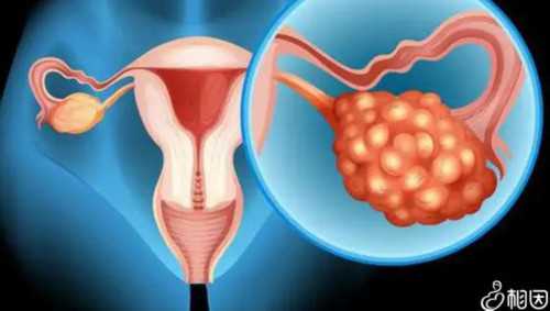 检查基因试管婴儿