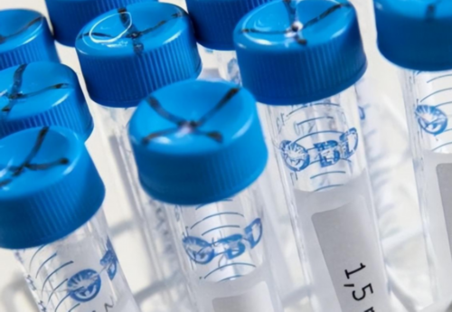 58代孕中心,质量好的精子一般是什么样的呢