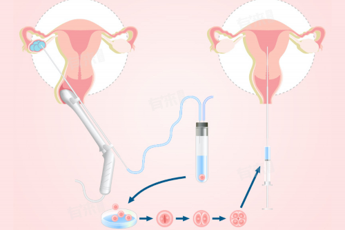 2026南昌卵巢早衰三代试管代生子三代试管代生子医院排名，4家医院均能够进行