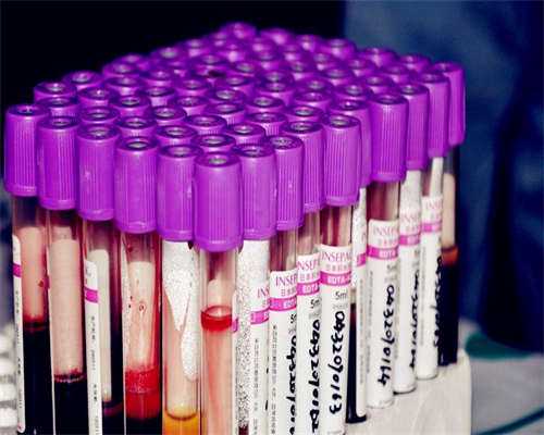 哈萨克斯坦可以做试管的正规医院解析