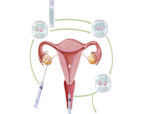 2026嘉兴三代代生孩子中介机构医院排名表？本地生殖机构成功率参考