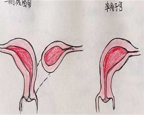 移植后一超孕囊偏小怎么办？还能补救成功吗？