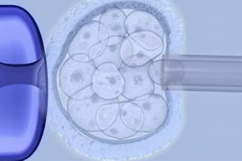 不孕直接选择试管婴儿吗？女性不孕直接选择试管婴儿吗？