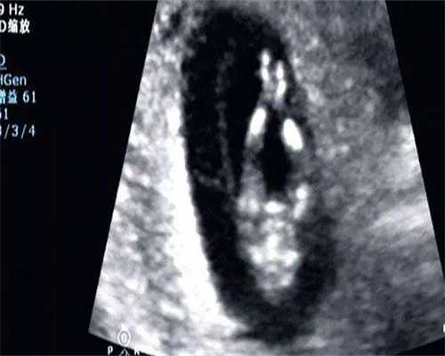 梅州做第一二三代哪里代生儿子价格公布！附哪里代生儿子医院介绍？