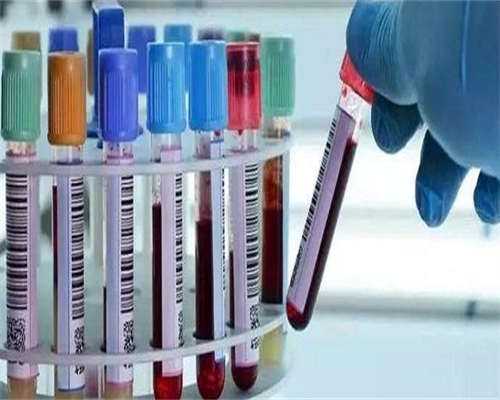 十月试管助孕_嘉宝供卵中心在哪里,做试管都会检查染色体_试管会检查染色体吗