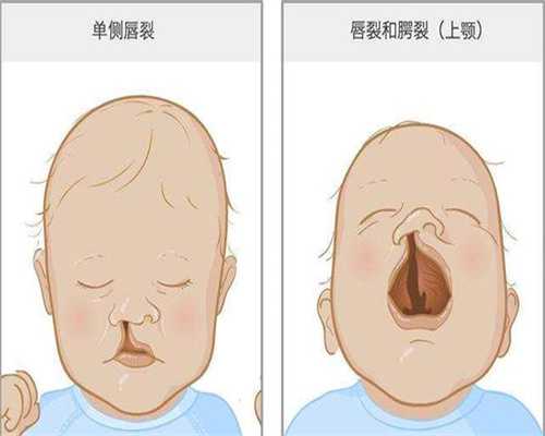 天津人工授精哪个医院好？哪里做找人代生价格成功率高