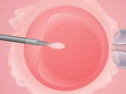 试管三筛检查什么 三试管婴儿成功率是多少