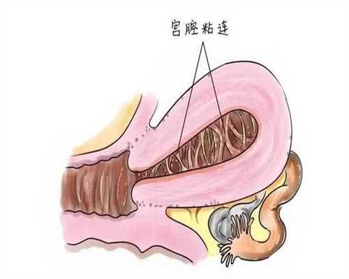 正规试管代怀：胎停育不管它会怎么样_胎停育的后果