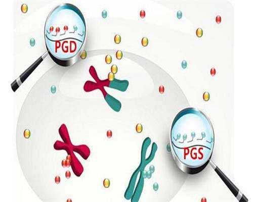 试管生儿子,不想吃激素药，但又有子宫内膜异位症，分享一张妙方帮你解决！