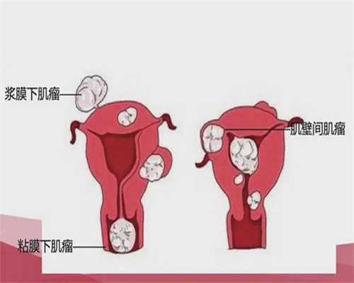 私人试管代怀：喝四物汤的注意事项(长期喝四物汤也有副作用)