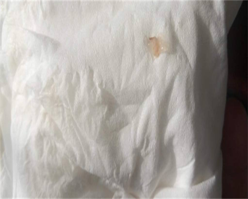 做试管算不孕不育吗