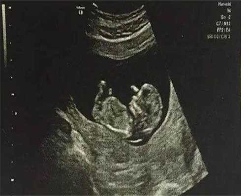 四代试管婴儿成功率高吗