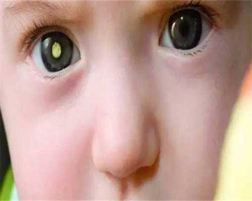 国内有哪些供卵中心_可以做代孕试管三代吗,试管婴儿染色体平行移位？染色体