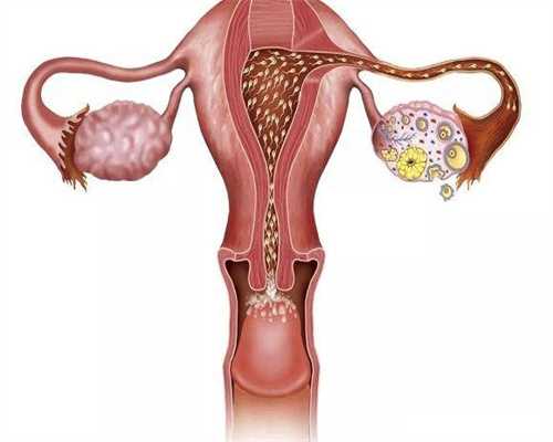 梅州试管生宝宝做一次预算，有省钱方法吗？